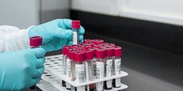Blood Test Can Reveal Your Internal Timing